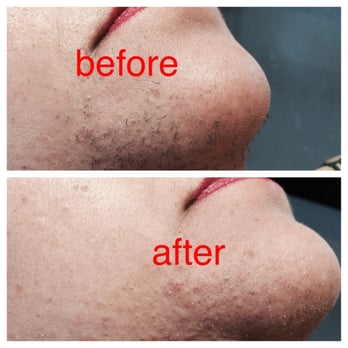 Rashma’s Eyebrow Threading - Chin and Neck - Threading Services Near Me - Stockton, California Rashma’s Eyebrow Threading - Chin and Neck - Threading Services Near Me - Stockton, California