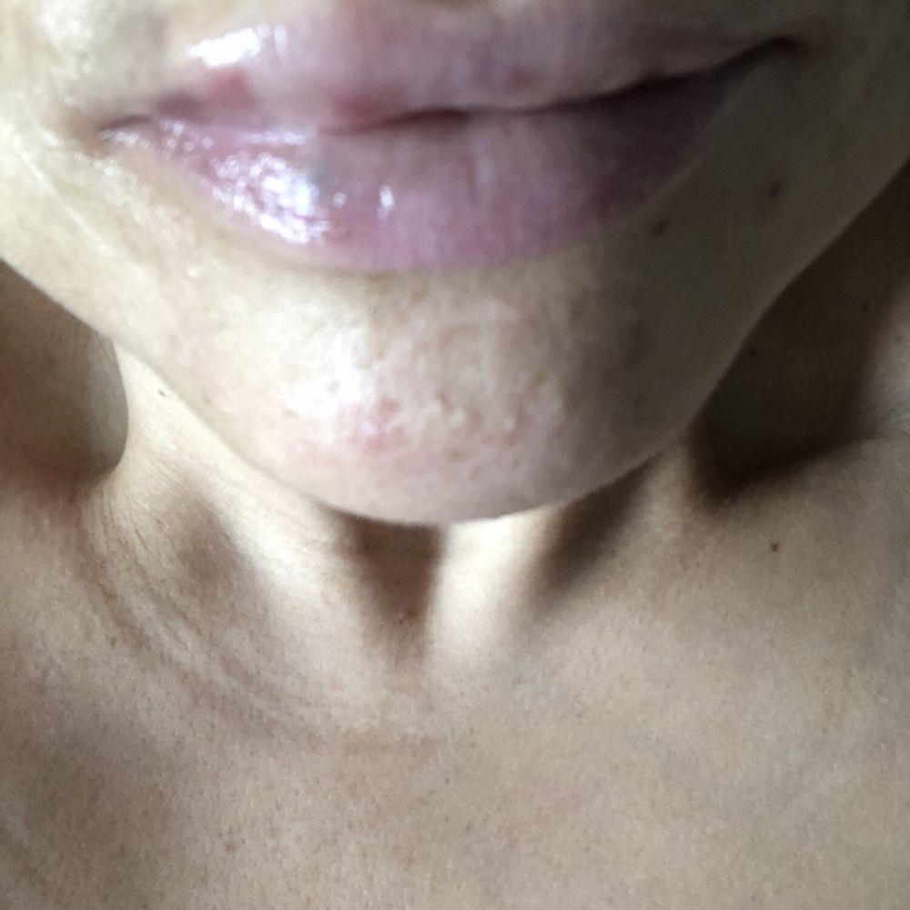 Ego - Body Contouring Near Me - Modesto, California