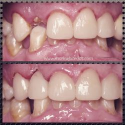 Mark White, DDS - Valley Dental Associates