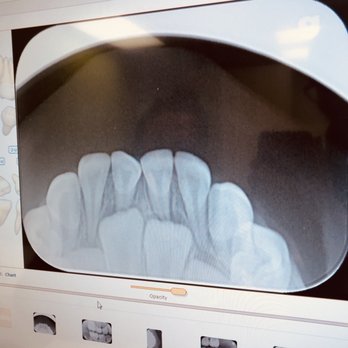 Hello Kids Dentistry - Pediatric Dentists Near Me - Bothell, Washington Hello Kids Dentistry - Pediatric Dentists Near Me - Bothell, Washington