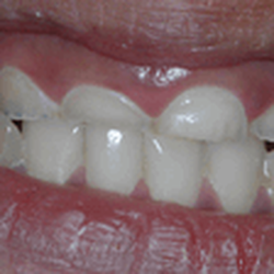 R Dentists - Before