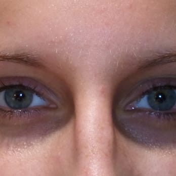 Flawless Permanent Cosmetics - Before Eyeliner - Cosmetic Surgeons Near Me - Chesterfield, Missouri