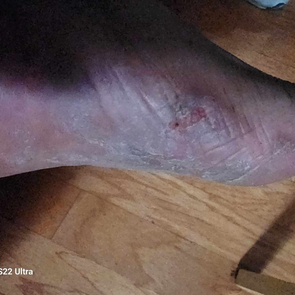 Solano dermatology associates vacaville (97) foto