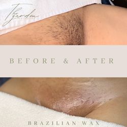 It is Wellness Holistic Health - Before and afters of a Brazilian Wax and Vajacial