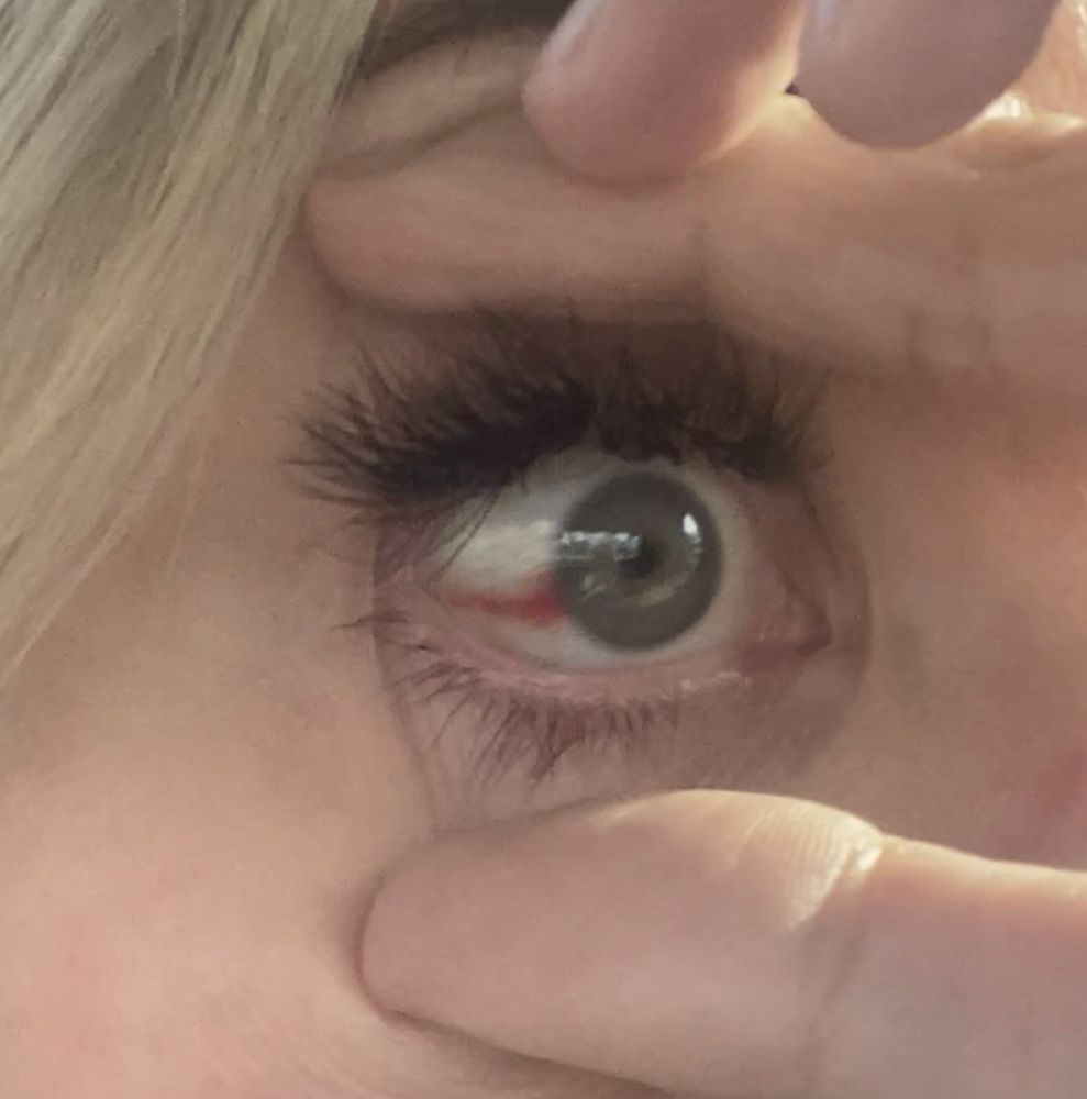 ACCENT EYECARE Updated September 2024 32 Photos & 26 Reviews 3990