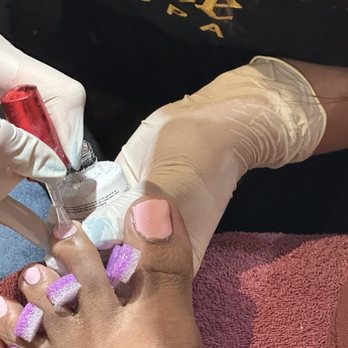 Castle Nail Spa - The ugly messed up big toe that they put Acrylic on. You can see a mile away how ugly uneven a lumpy this is. - Nail Salons Near Me - Dallas, Texas Castle Nail Spa - The ugly messed up big toe that they put Acrylic on. You can see a mile away how ugly uneven a lumpy this is. - Nail Salons Near Me - Dallas, Texas