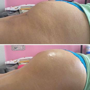 The Booty Bar - Body Contouring Near Me - San Bernardino, California The Booty Bar - Body Contouring Near Me - San Bernardino, California