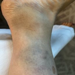 Not a healthy look for returning from a spa. Not a healthy look for returning from a spa.
