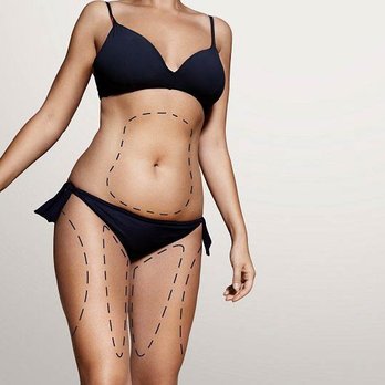 The Contour Day Spa - Body Contouring Near Me - Venice, Florida The Contour Day Spa - Body Contouring Near Me - Venice, Florida