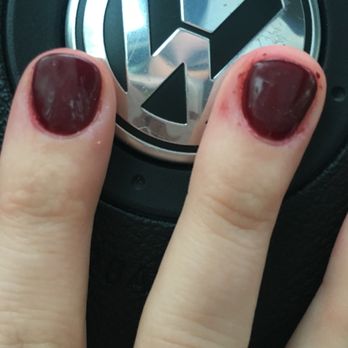 Lux Nails & Spa - This was the worst experience I've ever had at a nail salon. This is how my nails looked after a "professional" did them... - Waxing Near Me - Dedham, Massachusetts Lux Nails & Spa - This was the worst experience I've ever had at a nail salon. This is how my nails looked after a "professional" did them... - Waxing Near Me - Dedham, Massachusetts