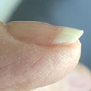 Luxe Nails And Spa - Lumpy and this is after he filed it!!! - Nail Salons Near Me - Modesto, California Luxe Nails And Spa - Lumpy and this is after he filed it!!! - Nail Salons Near Me - Modesto, California