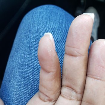 Beauty Lounge Spa - These were the two fingers he glued together - Nail Salons Near Me - Carson, California