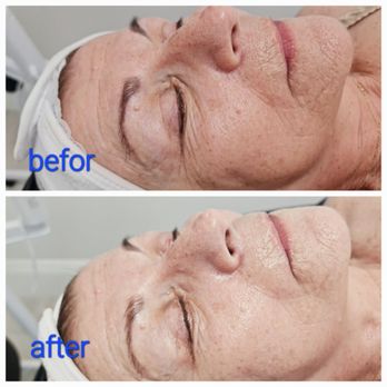 Skincare Pari - Skin Care Near Me - Glendale, California Skincare Pari - Skin Care Near Me - Glendale, California
