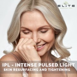 Elite Medical Spa - Remove sun spots and facial capillaries with IPL