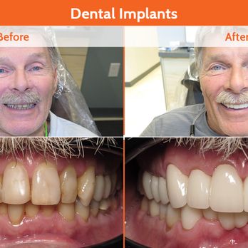 TruSmile Now - Endodontists Near Me - Chandler, Arizona TruSmile Now - Endodontists Near Me - Chandler, Arizona