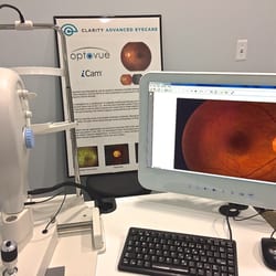 Clarity Advanced Eyecare - The OptoVue is a retinal camera that can document your eye health year after year. It gives YOU the view seen by the doctor!