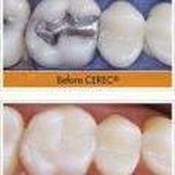 Gene Destefano, DDS - General Dentistry Near Me - Kingston, New York