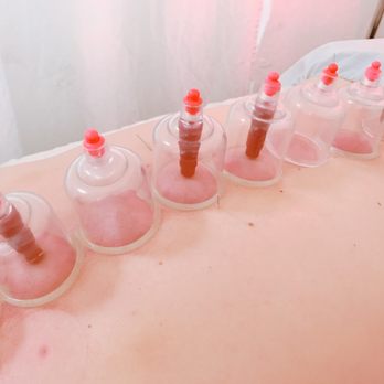 Pine Tree Acupuncture - Acupuncture Near Me - Fullerton, California Pine Tree Acupuncture - Acupuncture Near Me - Fullerton, California
