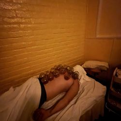 Relaxology Massage - Glass cupping