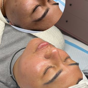 LV Aesthetics - Results - Medical Spas Near Me - Rancho Cucamonga, California LV Aesthetics - Results - Medical Spas Near Me - Rancho Cucamonga, California