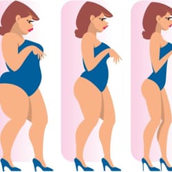 Luis A. Perez, MD - We specialized in weight loss and maintaining it, then further enhance your beauty with some cosmetic medicine