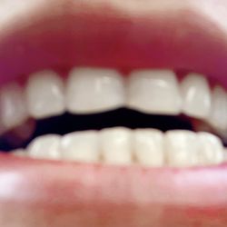 Jayshree Sawhney, DDS - Cranford Dental Arts