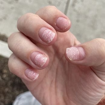 Corvallis Star Nails & Spa - Nail damage - Nail Salons Near Me - Corvallis, Oregon Corvallis Star Nails & Spa - Nail damage - Nail Salons Near Me - Corvallis, Oregon