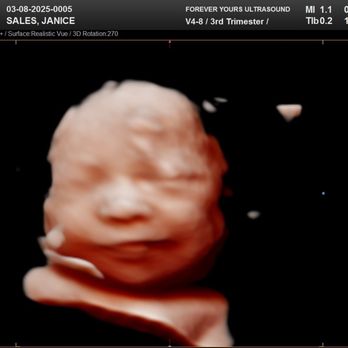Forever Yours Ultrasound - Prenatal/Perinatal Care Near Me - Irvine, California Forever Yours Ultrasound - Prenatal/Perinatal Care Near Me - Irvine, California