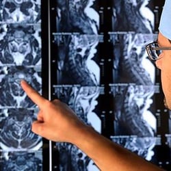 Joshua S Rovner, MD - Progressive Spine & Orthopaedics