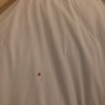 Spray Beach Hotel - blood stain on sheets - Hotels Near Me - Beach Haven, New Jersey