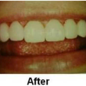 Helen S Kirscher, DDS - General Dentistry Near Me - Valparaiso, Indiana Helen S Kirscher, DDS - General Dentistry Near Me - Valparaiso, Indiana