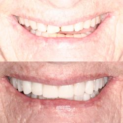 Illume Dental of McKinney