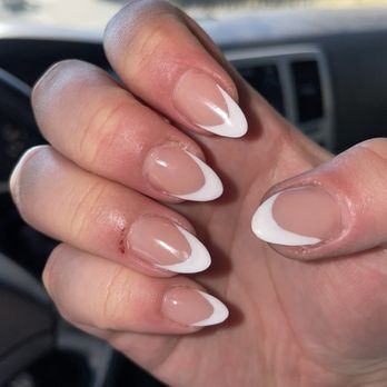 Nails Art - Right hand day after scabbed over - Nail Salons Near Me - Pittsburg, California