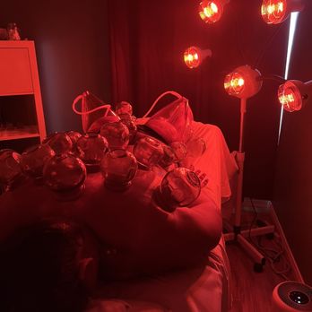 Cupping4Life - Massage Near Me - San Diego, California Cupping4Life - Massage Near Me - San Diego, California