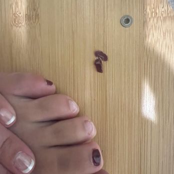 Glamour Nails - My pedicure was falling off in less than a week. As you can see by other toes there's no grow out and my nails from the same visit. - Nail Salons Near Me - Fitchburg, Wisconsin Glamour Nails - My pedicure was falling off in less than a week. As you can see by other toes there's no grow out and my nails from the same visit. - Nail Salons Near Me - Fitchburg, Wisconsin