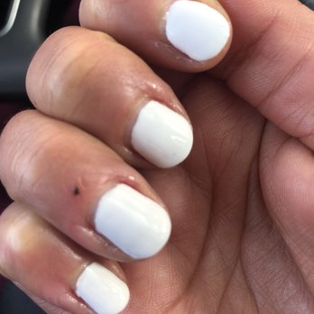 Nails and lashes by Ashley - Poor gel manicure - Eyelash Service Near Me - Paramount, California Nails and lashes by Ashley - Poor gel manicure - Eyelash Service Near Me - Paramount, California