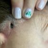 Botox by Dr Landsman - East Islip gift card