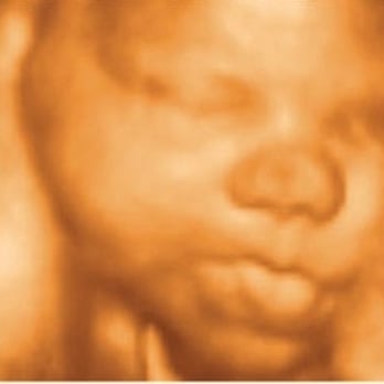 Stork Vision - Diagnostic Imaging Near Me - Lubbock, Texas Stork Vision - Diagnostic Imaging Near Me - Lubbock, Texas