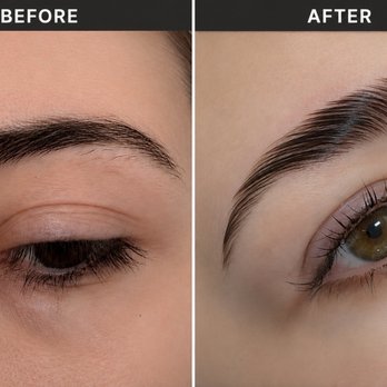 Soroor Beauty - My beautiful before and after :) - Skin Care Near Me - Newport Beach, California Soroor Beauty - My beautiful before and after :) - Skin Care Near Me - Newport Beach, California