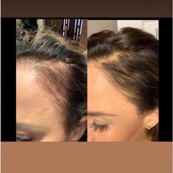 Transformations Esthetics & Wellness - Skin Care Near Me - Jupiter, Florida Transformations Esthetics & Wellness - Skin Care Near Me - Jupiter, Florida