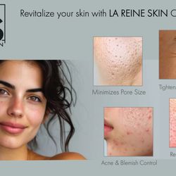 La Reine Skin Wellness Boutique - Your skin journey starts here!