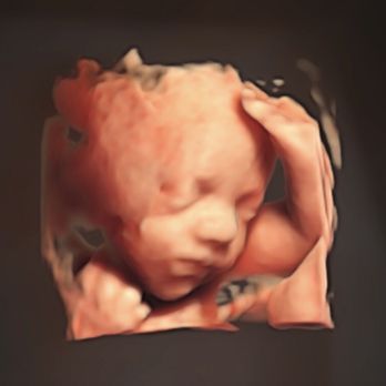 Unique Ultrasound - Diagnostic Imaging Near Me - Temecula, California Unique Ultrasound - Diagnostic Imaging Near Me - Temecula, California