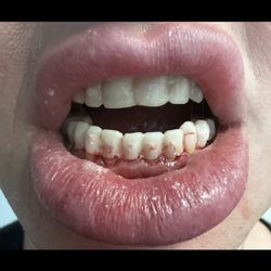 New Life Dental Implant Center