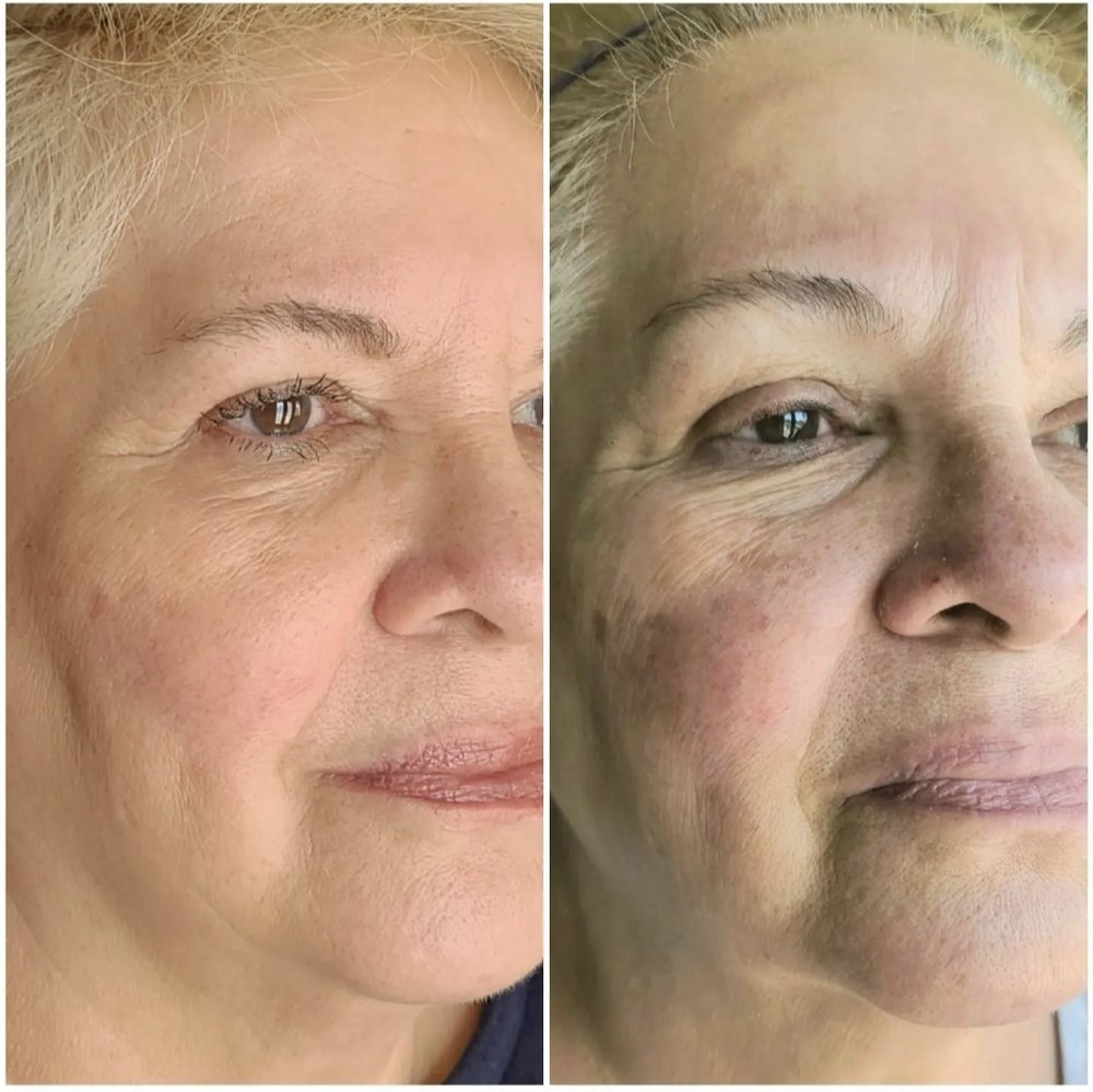 SMOOTHIES MEDICAL SPA 16 Reviews 3670 Grant Dr, Reno, Nevada