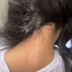 Lice Clinics of America - Cypress - 30 minutes after being home