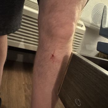 Tru by Hilton Terrell - The bed frame sticking out bit my shin. - Hotels Near Me - Terrell, Texas