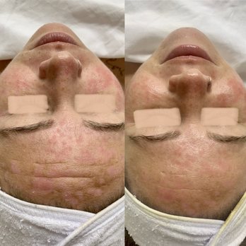 By Nikolle - Skin Rescue Facial - Eyebrow Services Near Me - Honolulu, Hawaii By Nikolle - Skin Rescue Facial - Eyebrow Services Near Me - Honolulu, Hawaii