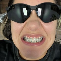 Temple Dental Trails - Braces
