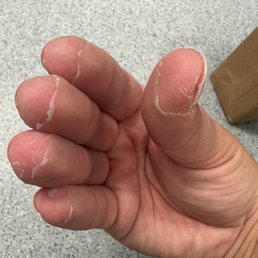 Fingers