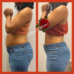 Allure Esthetics - Body contouring treatment. Non invasive lipo and Cavitation (fat reduction).